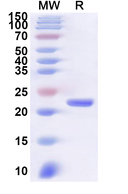 SDS-PAGE for Recombinant CVA6 P3C/Protease 3C Protein, N-His