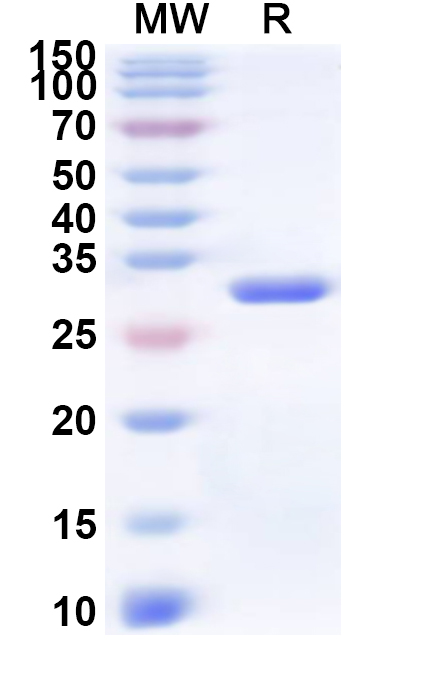 SDS-PAGE for Recombinant CVA6 VP2/Capsid protein VP2 Protein, N-His