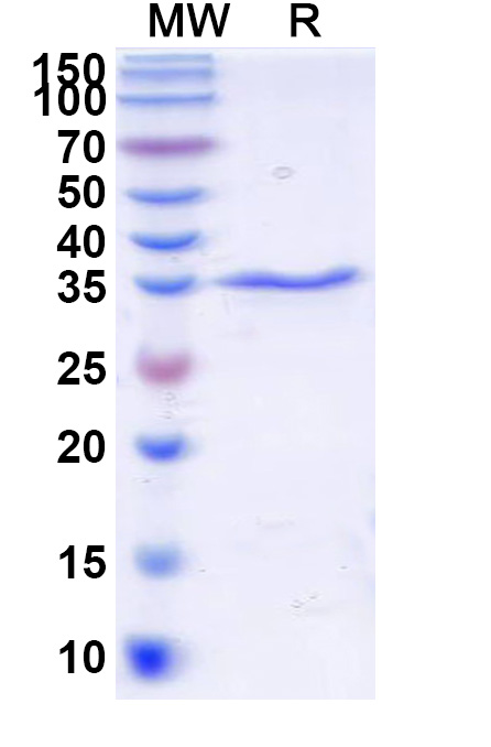SDS-PAGE for Recombinant E. coli O157:H7 FliC/Flagellin Protein, N-His