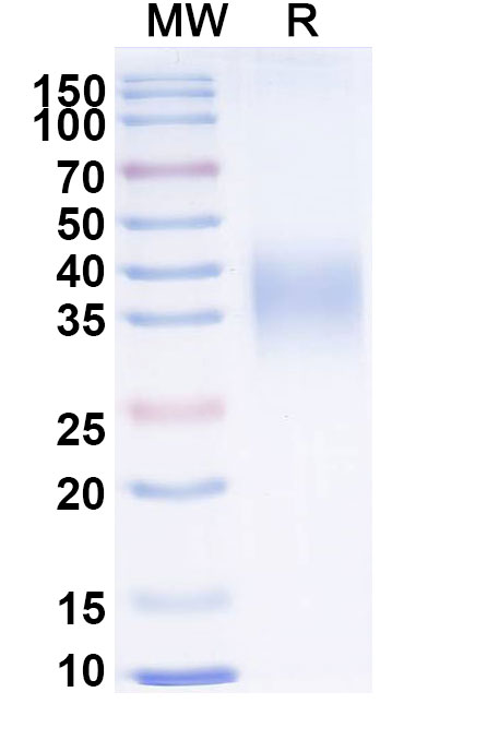 SDS-PAGE for Recombinant EBV/HHV4 GP42/Glycoprotein 42 Protein, C-His