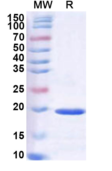 SDS-PAGE for Recombinant European white birch PPIase/Bet v 7 Protein, N-His