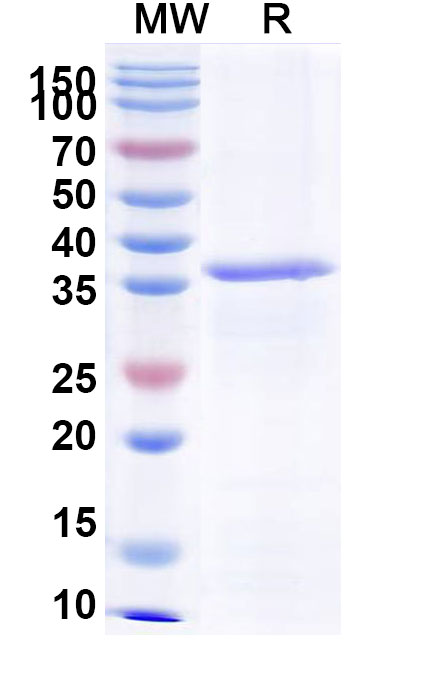 SDS-PAGE for Recombinant EV71 VP1/Capsid protein VP1, N-His