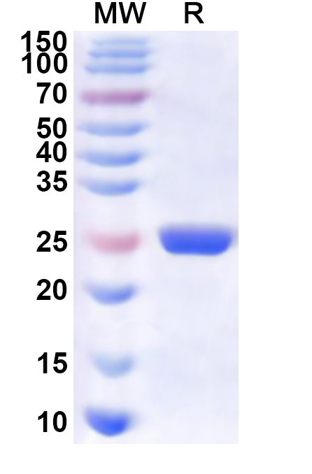 SDS-PAGE for Recombinant FHV-1 capsid maturation protease, N-His