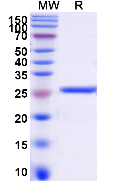SDS-PAGE for Recombinant Flag tag Control Protein