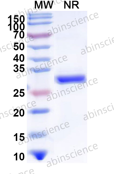SDS-PAGE for Recombinant FMDV Capsid protein VP1 Protein, N-His