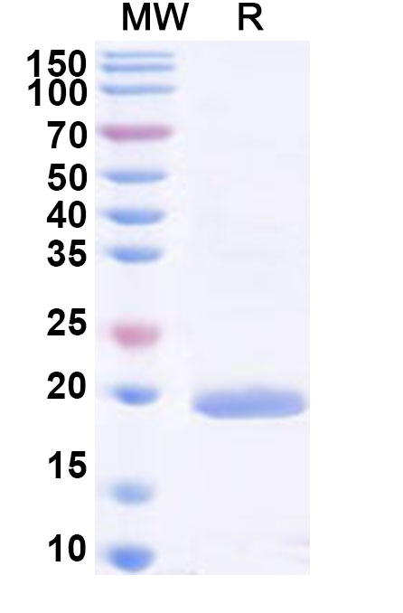 SDS-PAGE for Recombinant HAstV-5 Serine Protease, N-His