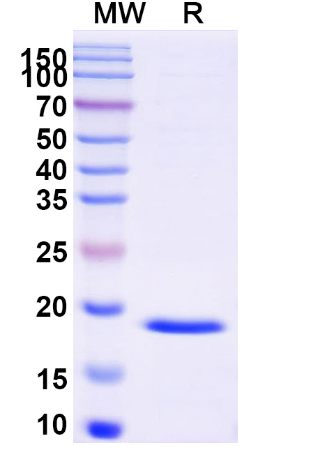 SDS-PAGE for Recombinant Helicobacter pylori ftnA/pfr Protein, N-His