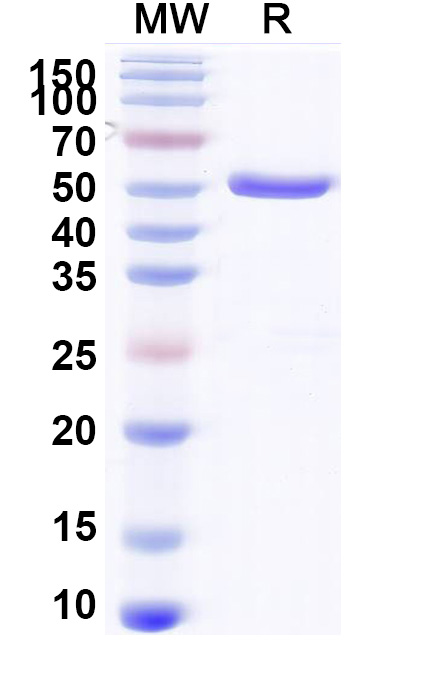SDS-PAGE for Recombinant Helicobacter pylori HP_1019/Periplasmic serine endoprotease DegP-like