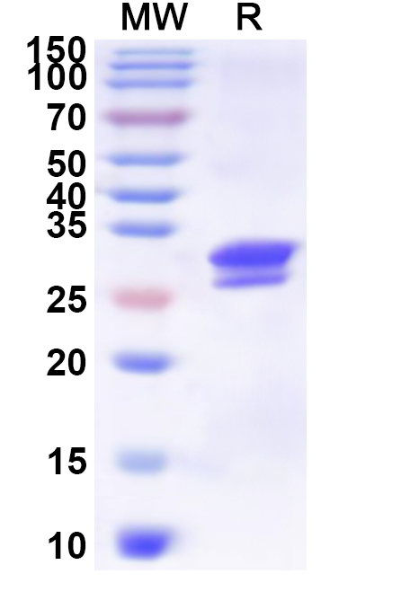 SDS-PAGE for Recombinant Helicobacter pylori ureA/Urease subunit alpha Protein, N-His