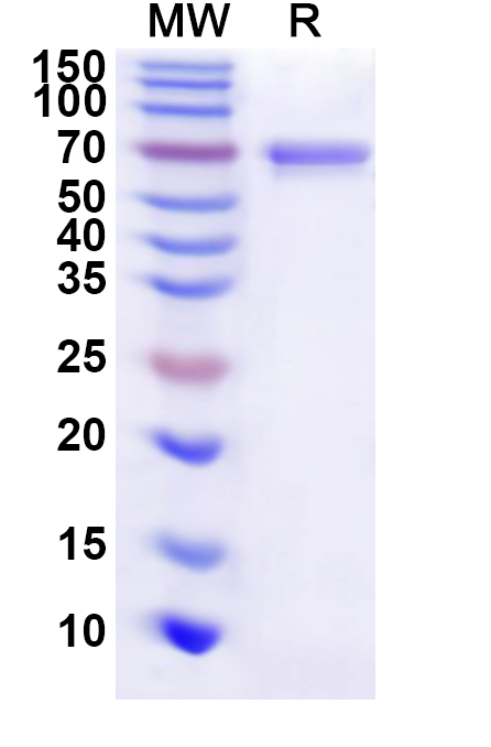 SDS-PAGE for Recombinant Helicobacter pylori ureB/Urease subunit beta Protein, N-His