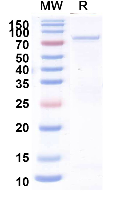SDS-PAGE for Recombinant HPV18 L1/Major capsid protein L1 Protein, N-GST & C-His