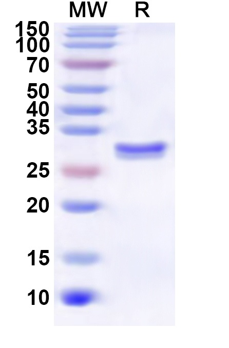 SDS-PAGE for Recombinant Human ABCC10 Protein, N-His