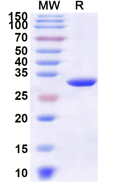 SDS-PAGE for Recombinant Human ABL1 Protein, N-His