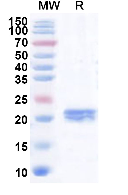 SDS-PAGE for Recombinant Human ABRAXAS2 Protein, N-His