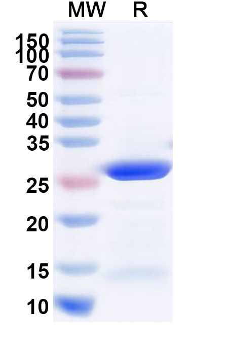SDS-PAGE for Recombinant Human ACO1 Protein, N-His