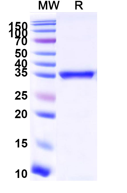 SDS-PAGE for Recombinant Human ACTN4, N-His