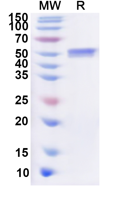 SDS-PAGE for Recombinant Human ACTR1B Protein, N-His