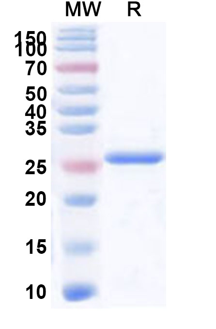 SDS-PAGE for Recombinant Human ADCY7 Protein, N-His