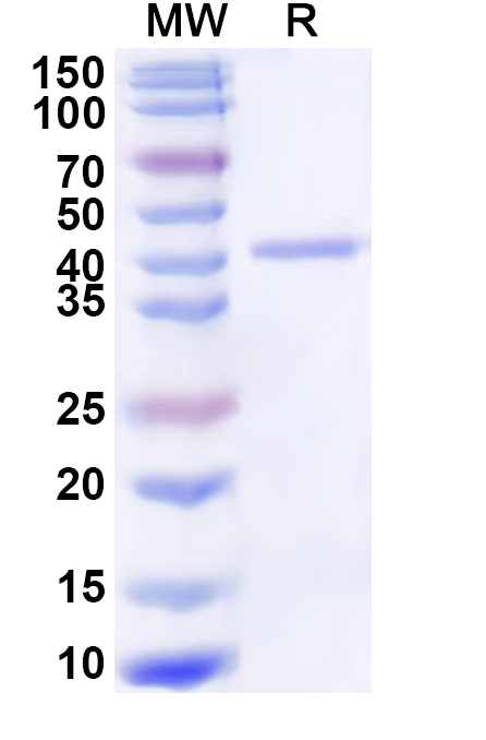 SDS-PAGE for Recombinant Human ADH6 Protein, N-His