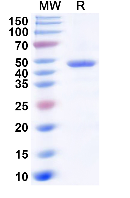 SDS-PAGE for Recombinant Human ADH7 Protein, N-His