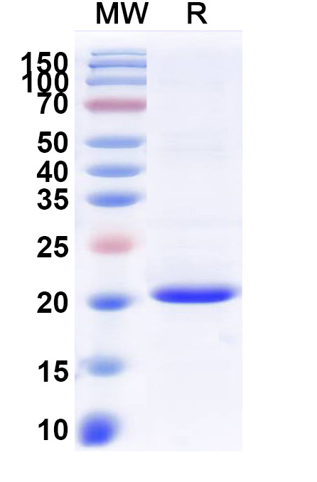 SDS-PAGE for Recombinant Human ADI1 Protein, N-His