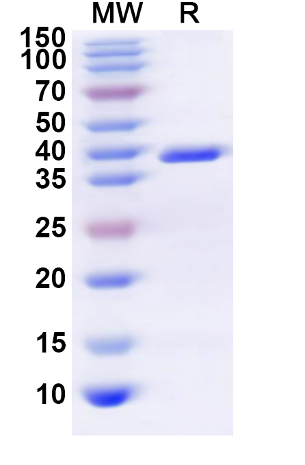 SDS-PAGE for Recombinant Human ADORA1 Protein, N-GST & C-His