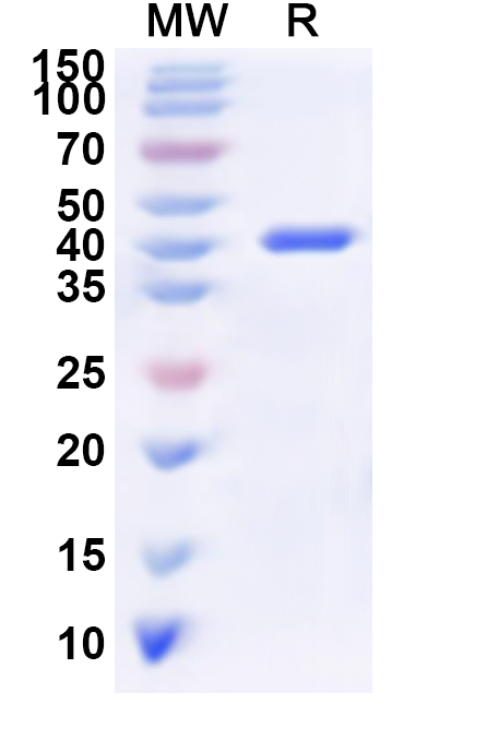 SDS-PAGE for Recombinant Human ADPRH Protein, N-His