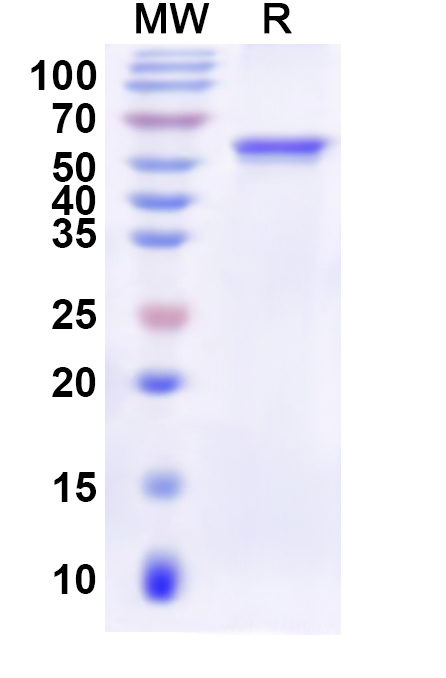 SDS-PAGE for Recombinant Human AFG2A Protein, N-His
