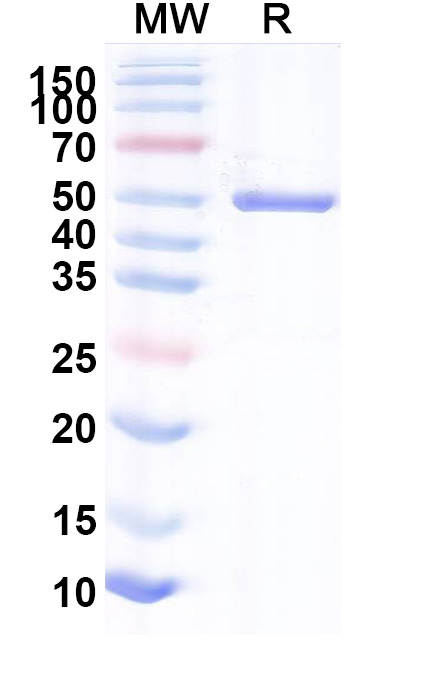 SDS-PAGE for Recombinant Human AHCY, N-His