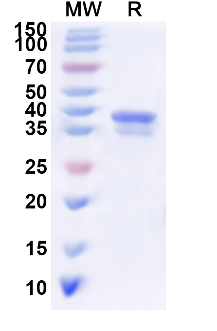 SDS-PAGE for Recombinant Human AKR1C2 Protein, N-His
