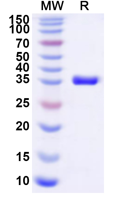 SDS-PAGE for Recombinant Human AKR1D1 Protein, N-His