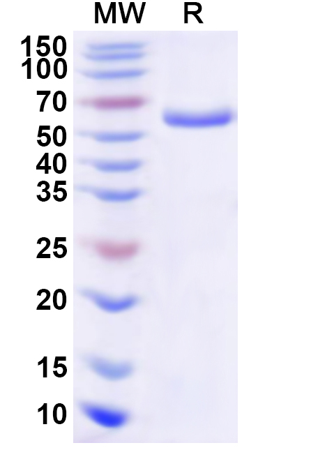 SDS-PAGE for Recombinant Human ALDH9A1 Protein, N-His