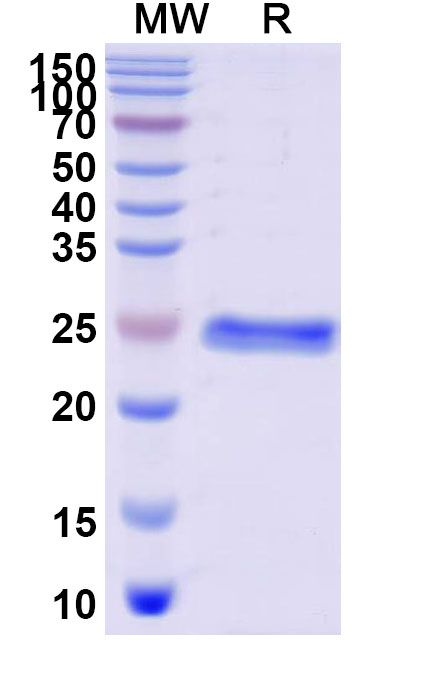 SDS-PAGE for Recombinant Human AMBP, N-His