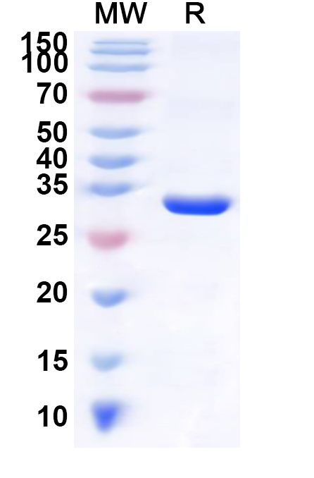 SDS-PAGE for Recombinant Human AMER1 Protein, N-GST & C-His