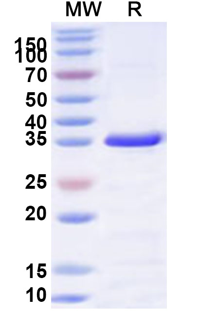 SDS-PAGE for Recombinant Human AP4M1 Protein, N-His