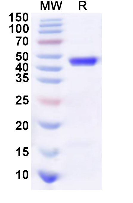 SDS-PAGE for Recombinant Human APBA1 Protein, N-His