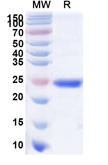SDS-PAGE for Recombinant Human APOBEC3H Protein, N-His
