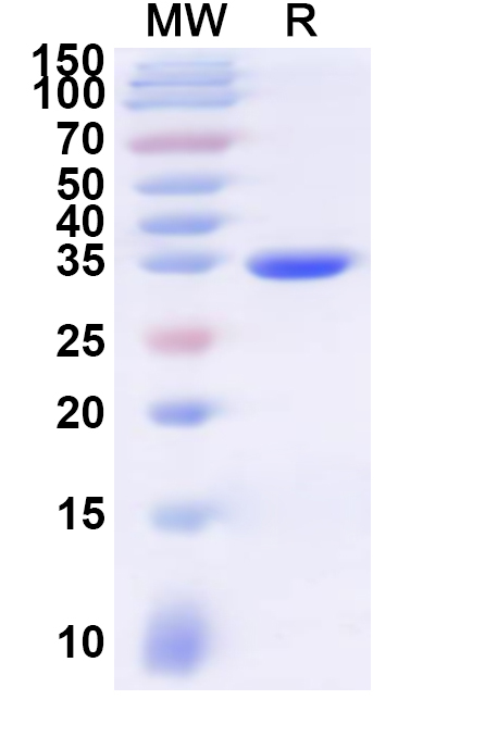 SDS-PAGE for Recombinant Human AQP8 Protein, N-GST & C-His
