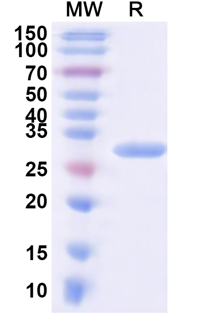 SDS-PAGE for Recombinant Human ARFIP1 Protein, N-His
