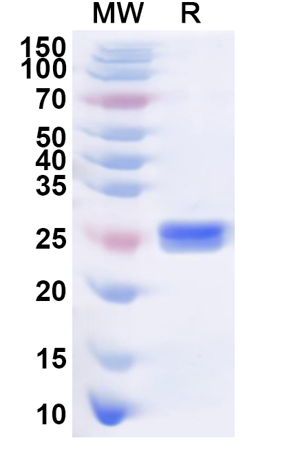 SDS-PAGE for Recombinant Human ARHGAP21 Protein, N-His