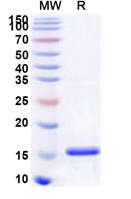 SDS-PAGE for Recombinant Human ARHGEF15 Protein, N-His