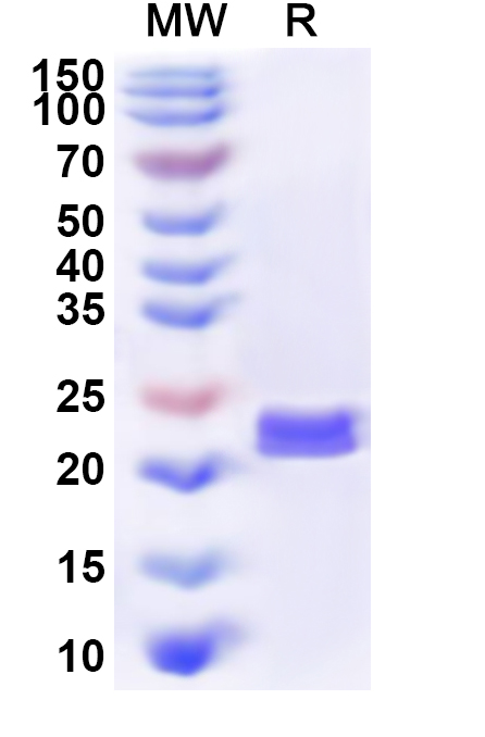 SDS-PAGE for Recombinant Human ARL4D Protein, N-His