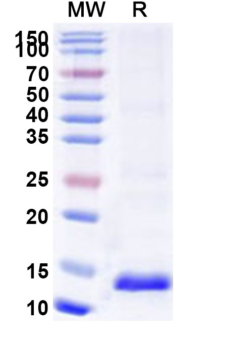 SDS-PAGE for Recombinant Human ARPC5 Protein, N-His