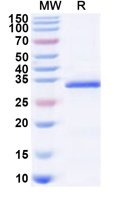 SDS-PAGE for Recombinant Human ART1 Protein, N-His