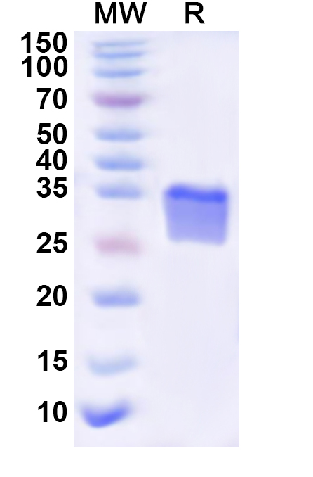 SDS-PAGE for Recombinant Human ART3 Protein, N-His