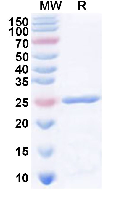 SDS-PAGE for Recombinant Human ART4 Protein, N-His