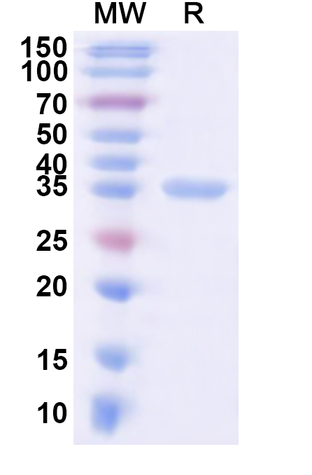 SDS-PAGE for Recombinant Human ASPA Protein, N-His