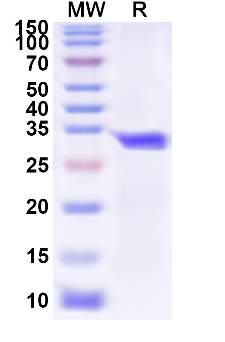 SDS-PAGE for Recombinant Human ATG10 Protein, N-His