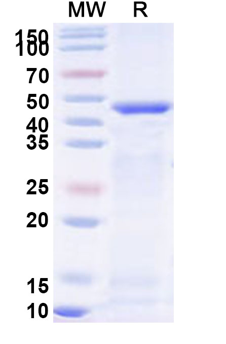 SDS-PAGE for Recombinant Human ATG4B Protein, N-His