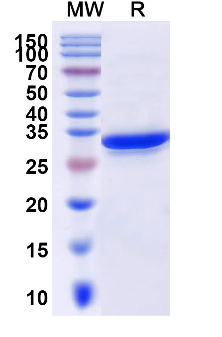 SDS-PAGE for Recombinant Human ATG5, N-His